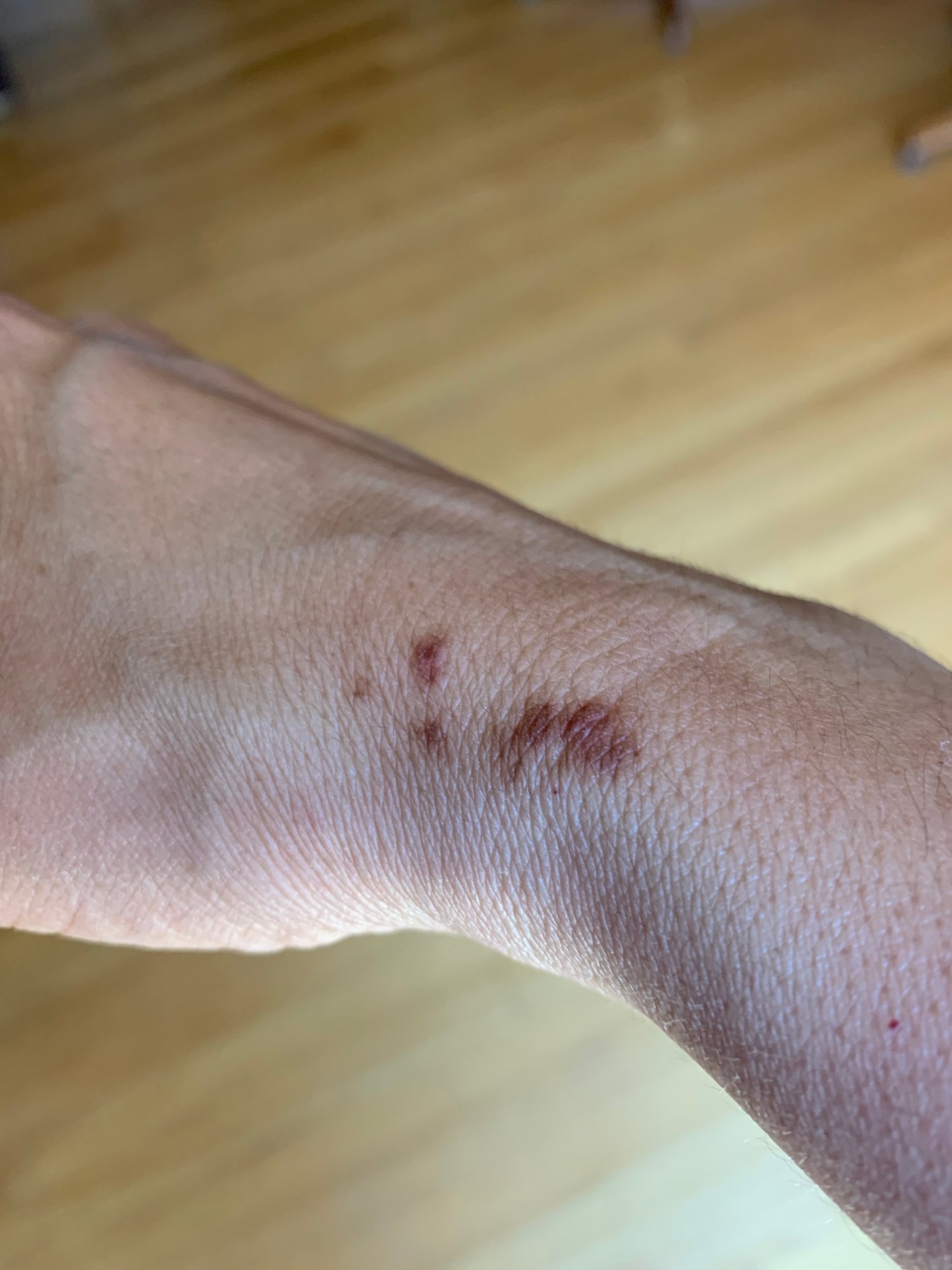 Cleaver-Rash   Katrina-Matos